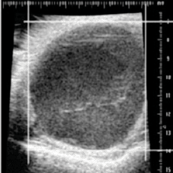 Image: Ultrasound imaging of mouse tumor showing response to chemotherapy. The mouse model allowed researchers to derive a new biomarker of chemotherapy responsiveness (Photo courtesy of Perou Laboratory at the University of North Carolina).